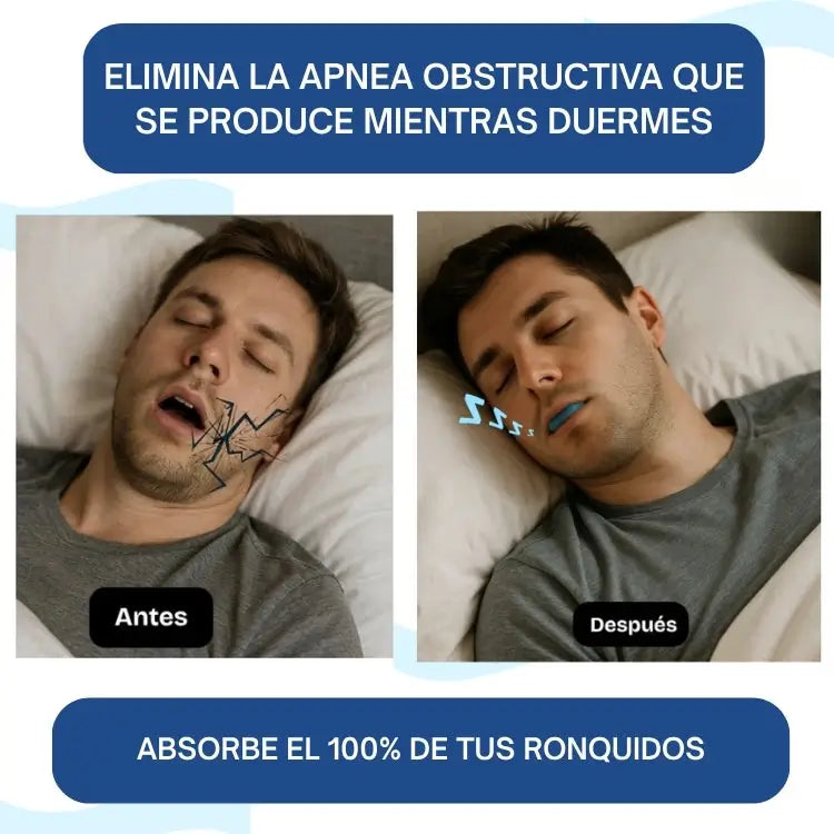 Brux-Z™ | Placa Bucal Antirronquidos para Dormir en Paz